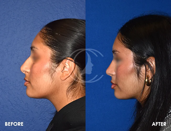 CONDERMAN_EK_B&A_RHINO_1