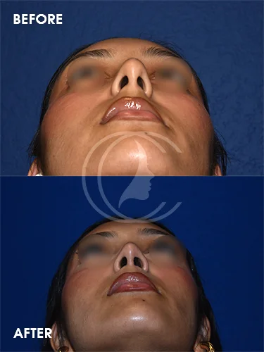 CONDERMAN_EK_B&A_RHINO_2