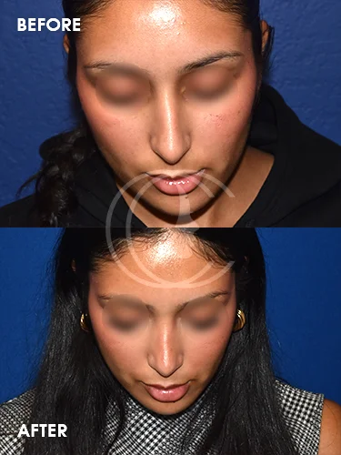 CONDERMAN_EK_B&A_RHINO_3