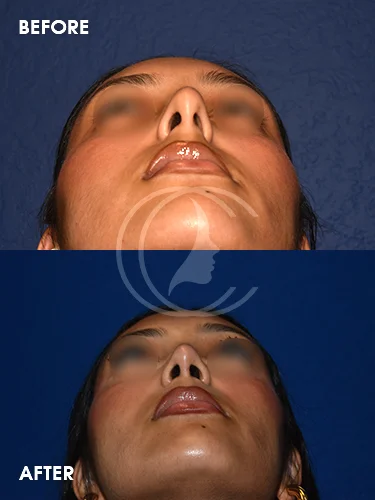 CONDERMAN_EK_B&A_RHINO_4