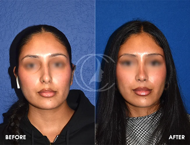 CONDERMAN_EK_B&A_RHINO_5