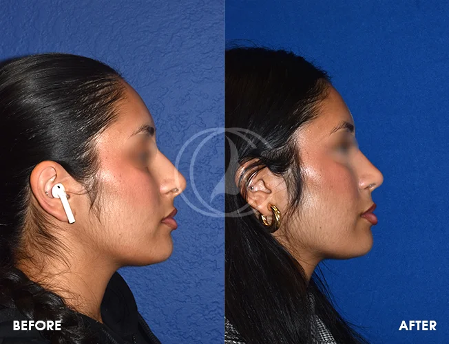 CONDERMAN_EK_B&A_RHINO_6