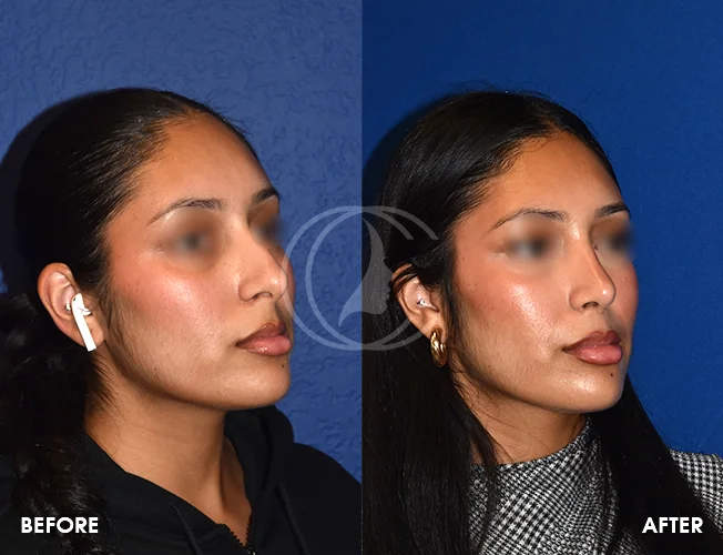 CONDERMAN_EK_B&A_RHINO_7