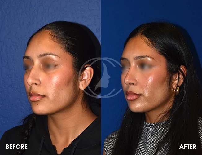 CONDERMAN_EK_B&A_RHINO_8