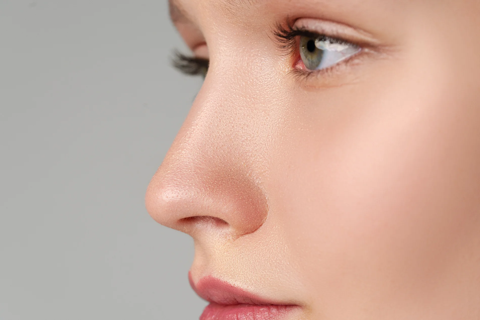 28-year-old patient 4 months after septorhinoplasty for nasal obstruction and nasal asymmetry at Conderman Facial Plastic Surgery in Orinda, CA